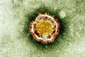 Naujasis koronavirusas gali būti perduodamas vieno žmogaus kitam?