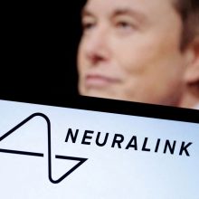 E. Muskas: pirmajam žmogui buvo įdėtas „Neuralink“ smegenų implantas, jis sveiksta