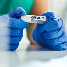 Koronaviruso statistika: 21 naujas atvejis, mirčių nefiksuota