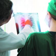 Plaučių vėžys: kodėl į užsitęsusį kosulį būtina atkreipti dėmesį