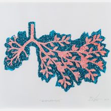 Menininko įkvėpimo šaltinis – plaučių liga