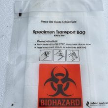 Šiukšlių konteineryje – netikėtas radinys: ant dėžės įspėjimas apie biologinį pavojų