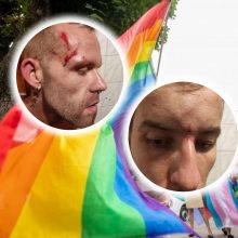 Po homofobiško išpuolio G. Sidiniauskas ir jo vaikinas tebesapnuoja košmarus