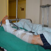 Kauno ligoninėje – pacientų antplūdis, sužalojimai itin sunkūs