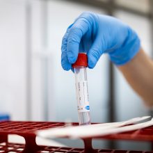 COVID-19 statistika: 29 nauji atvejai, mirčių nefiksuota