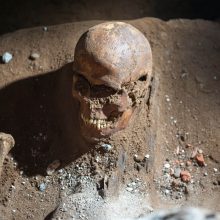 Pasekmės: archeologų teigimu, įskilusi kaukolė dar nereiškia, kad žmogus buvo sunkiai sužeistas – šie pažeidimai galėjo atsirasti įlūžus karstui.