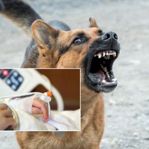 Skaudi nelaimė: voljere šuo apkandžiojo trijų metų vaiką