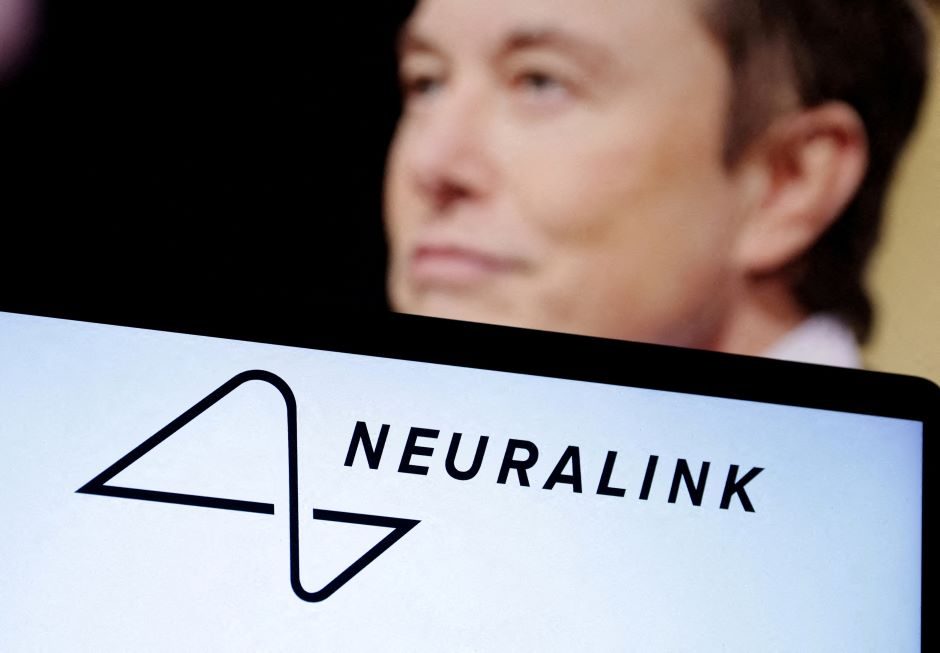 E. Muskas: pirmajam žmogui buvo įdėtas „Neuralink“ smegenų implantas, jis sveiksta