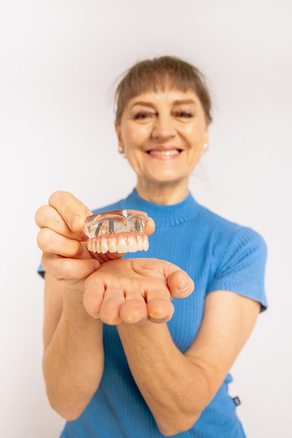 Dantų atkūrimas per parą – implantacijos laimėjimas, leidžiantis akimirksniu susigrąžinti šypseną