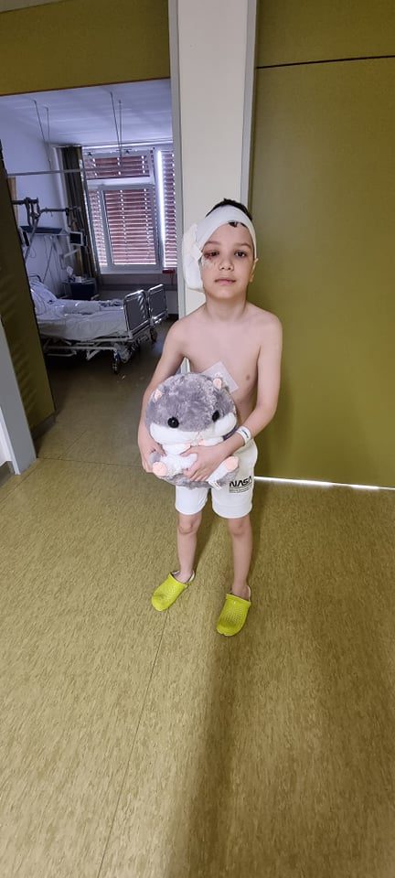Žiauriai šuns sukandžiotas berniukas – vėl medikų rankose: dabar jis lyg krištolinis