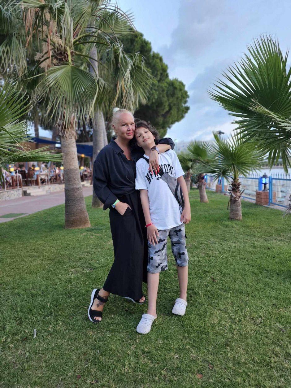 Šuns sukandžioto berniuko mama: matydama iš gabalų surinktą sūnų, išmokau pamoką
