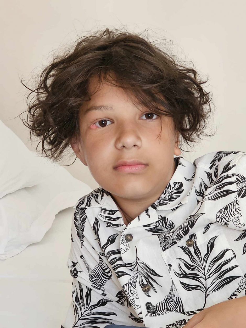 Šuns sukandžioto berniuko mama: matydama iš gabalų surinktą sūnų, išmokau pamoką