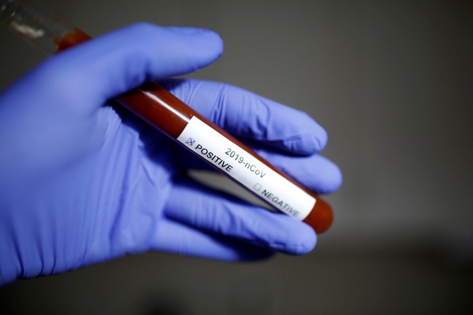 Europoje užfiksuota daugiau kaip milijonas užsikrėtimo koronavirusu atvejų