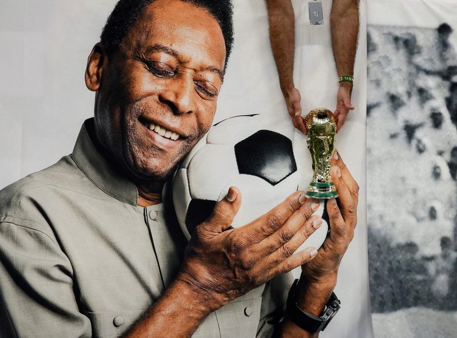 Žiniasklaida: legendinio Brazilijos futbolininko Pele būklė – sunki