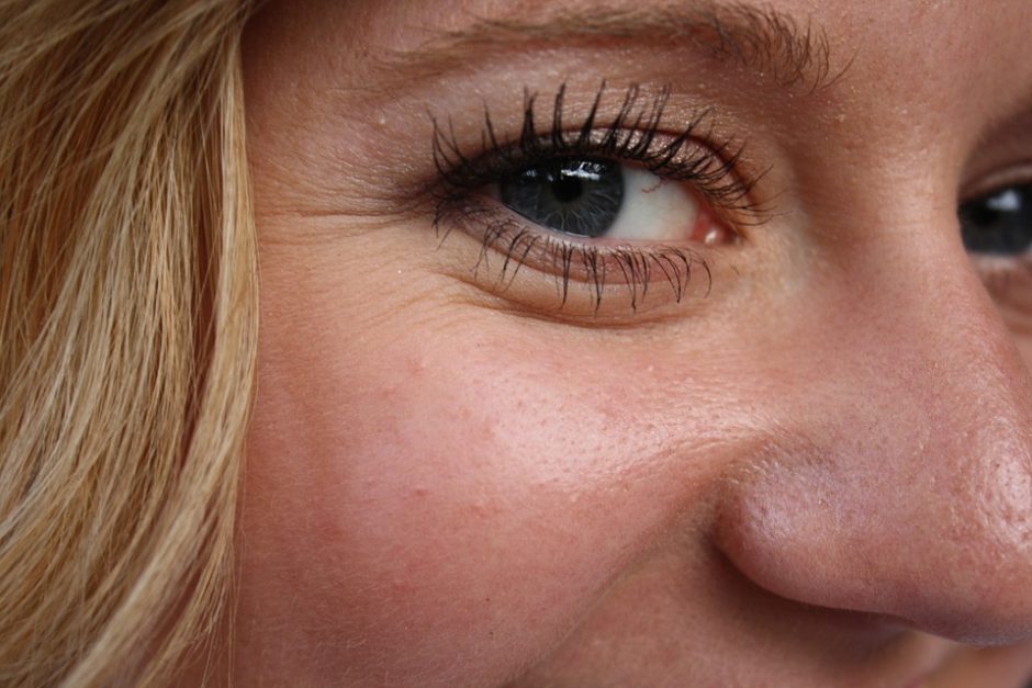 Fotosenėjimas – odos pokyčių pradžia, kurią galima sustabdyti