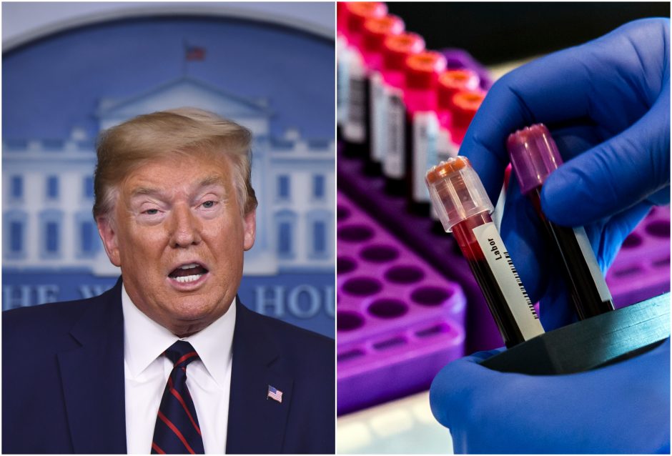 D. Trumpui atliktas antras tyrimas dėl koronaviruso, atsakymas – neigiamas