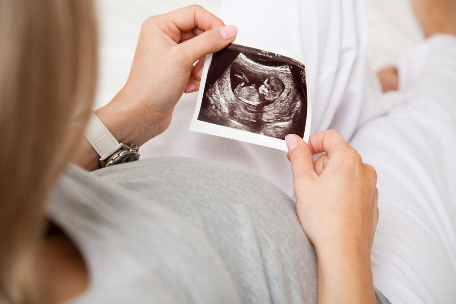 JAV respublikonai nori drausti abortus po 20-osios nėštumo savaitės