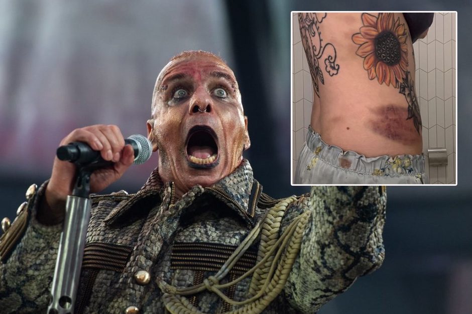 Policija patvirtino, kad sulaukė iškvietimo po „Rammstein“ koncerto: buvo kviesta ir greitoji