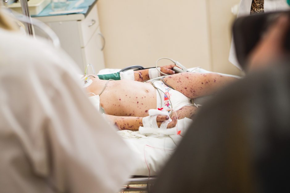 Santaros klinikose nuo meningokoko mirė dvimetė mergaitė