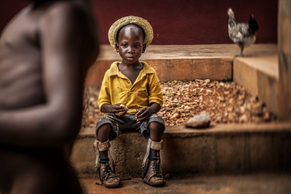 UNICEF Metų nuotraukoje – berniukas iš Togo