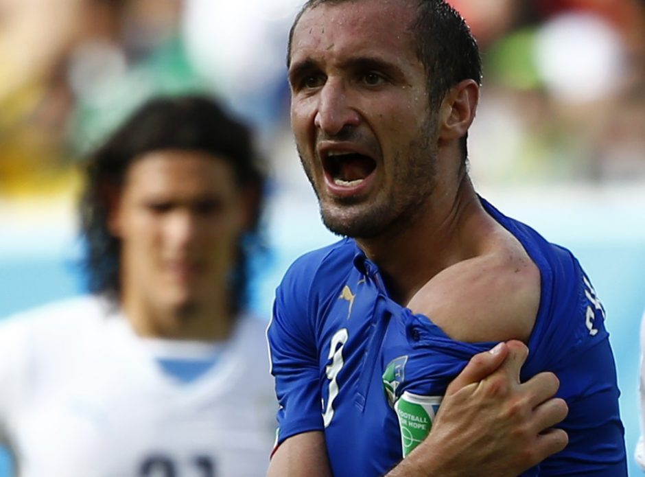 Urugvajaus rinktinės žvaigždė L. Suarezas įkando italui G. Chiellini į petį