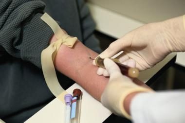 D. Britanijoje gėjams bus leista tapti kraujo donorais