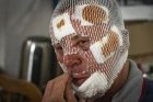 454-oji karo Ukrainoje diena 454-oji karo Ukrainoje diena