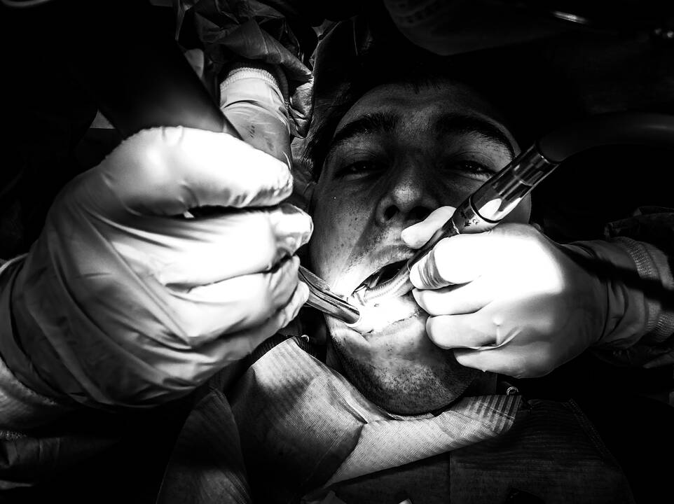 Impulsas: „Viską, ką norėjau pasakyti, sudėjau į fotografiją. Kai kurie dalykai yra universalūs ir jų nereikėtų aiškinti“, – žiūrovus laisvai interpretuoti jo kūrinį ragina A. Gudas.