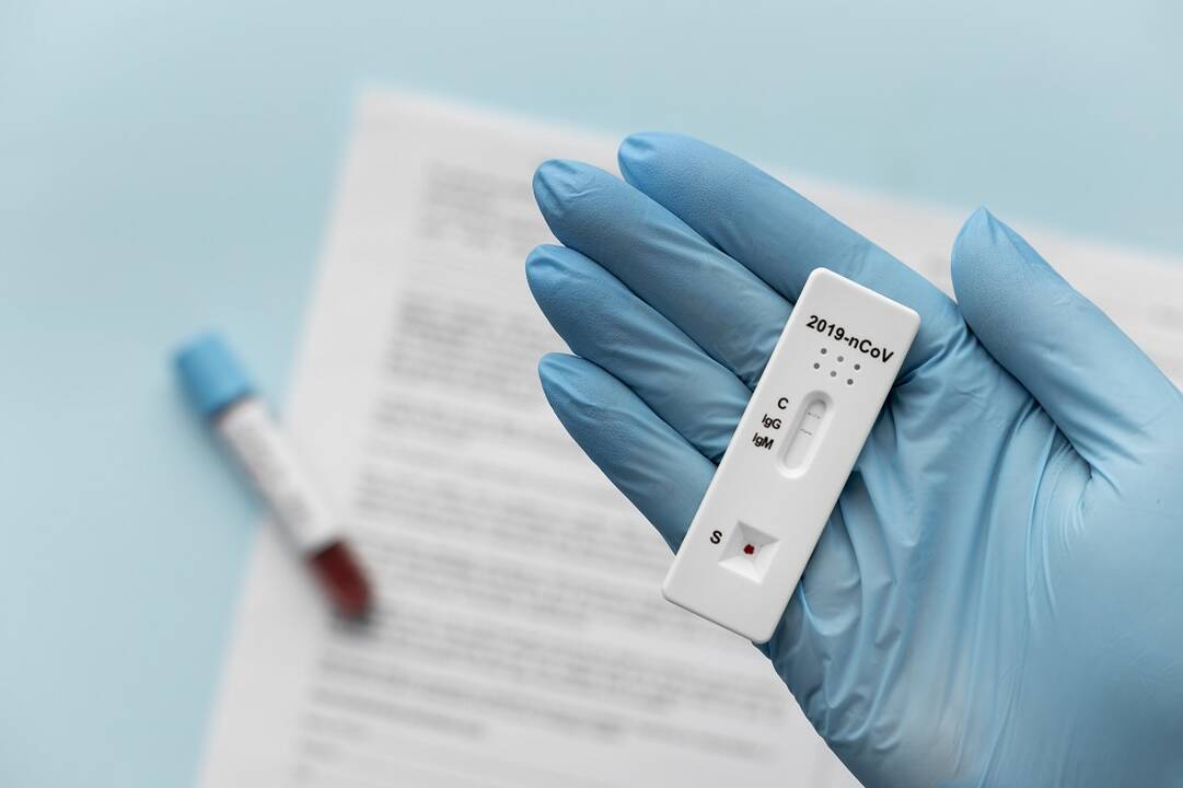 COVID-19 statistika: per parą užfiksuoti 469 nauji atvejai, mirusių nėra