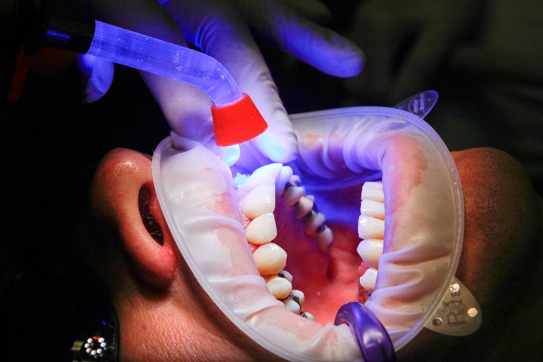 Valdantieji sieks odontologų licencijavimą grąžinti Odontologų rūmams