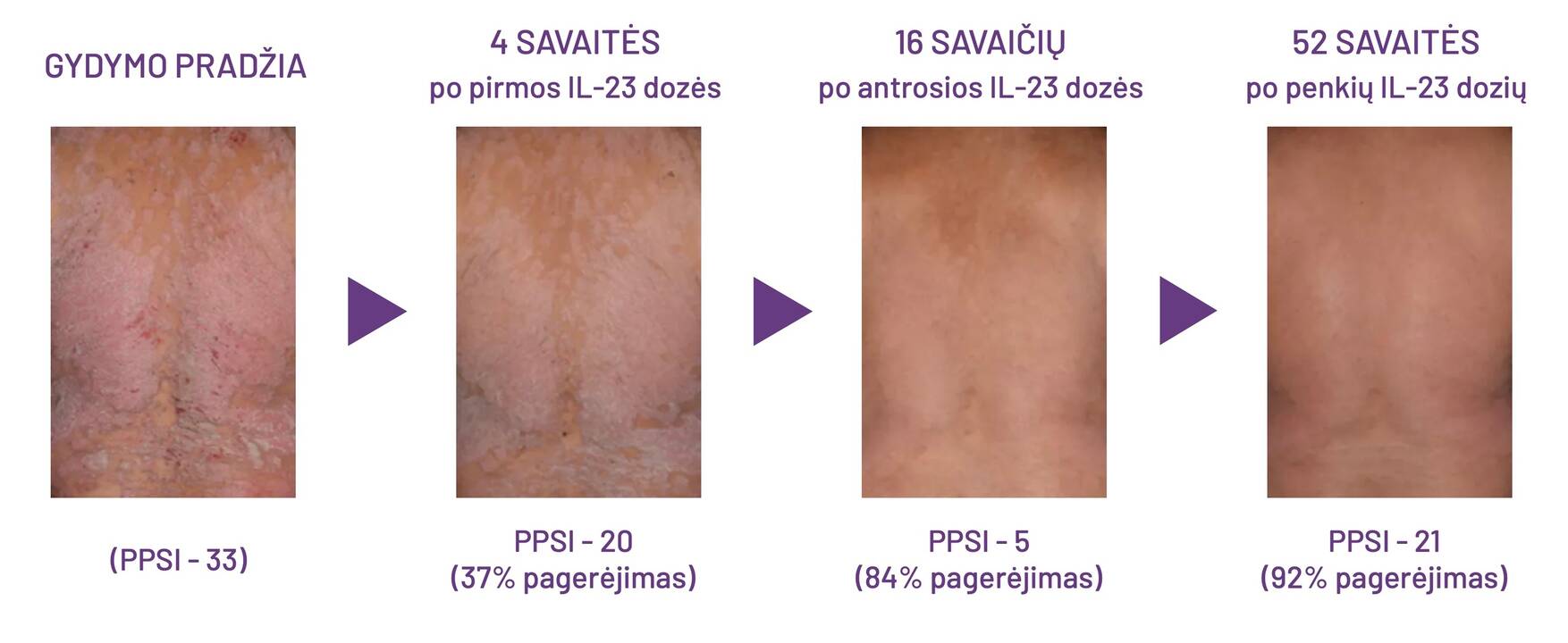 Klaipėdos universitetinės ligoninės (KUL) Infekcinių ligų departamento vadovė Jolanta Česienė.