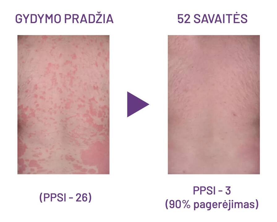 Klaipėdos universitetinės ligoninės (KUL) Infekcinių ligų departamento vadovė Jolanta Česienė.