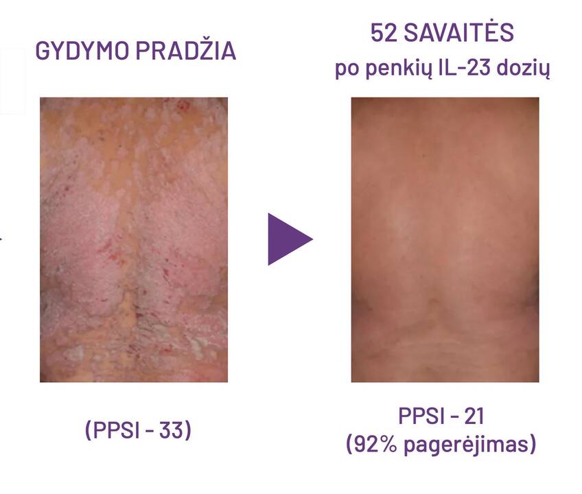 Klaipėdos universitetinės ligoninės (KUL) Infekcinių ligų departamento vadovė Jolanta Česienė.