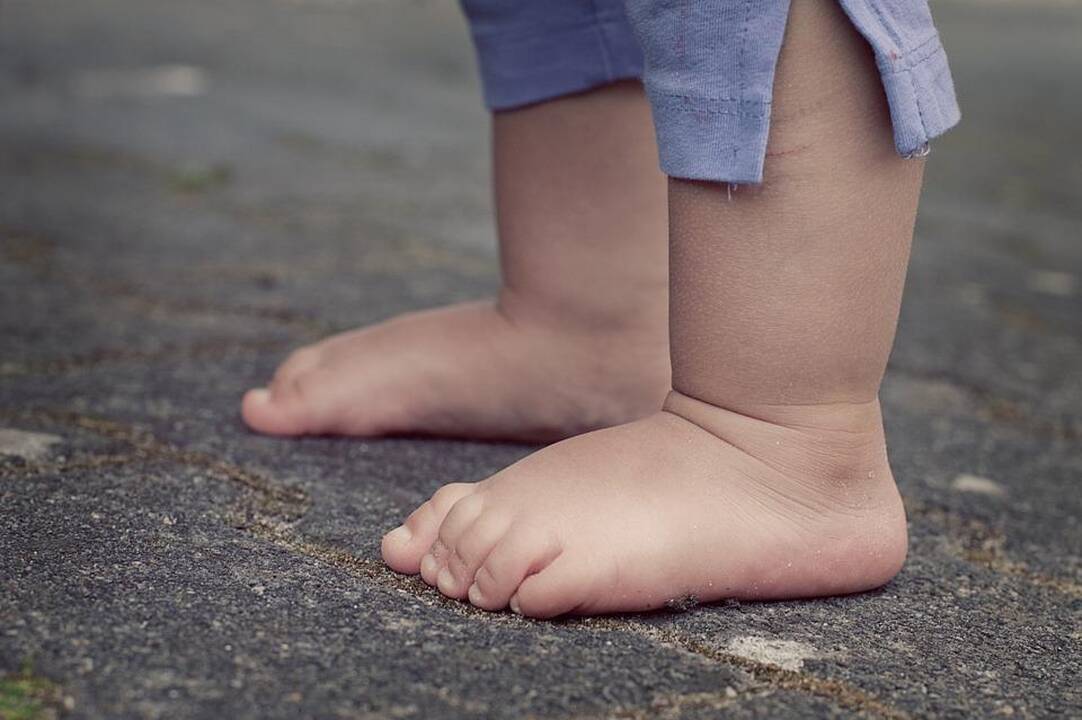 Plokščiapėdystė: į ką atkreipti dėmesį?