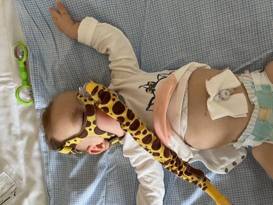 Viltis: mergaitės būtį temdo reta genetinė liga, pasėjusi nežinią dėl ateities.