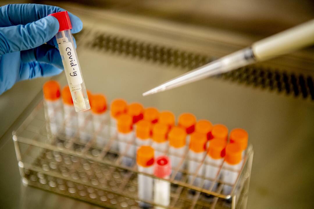 Maisto ir veterinarijos rizikos vertinimo institute – tyrimai dėl COVID-19