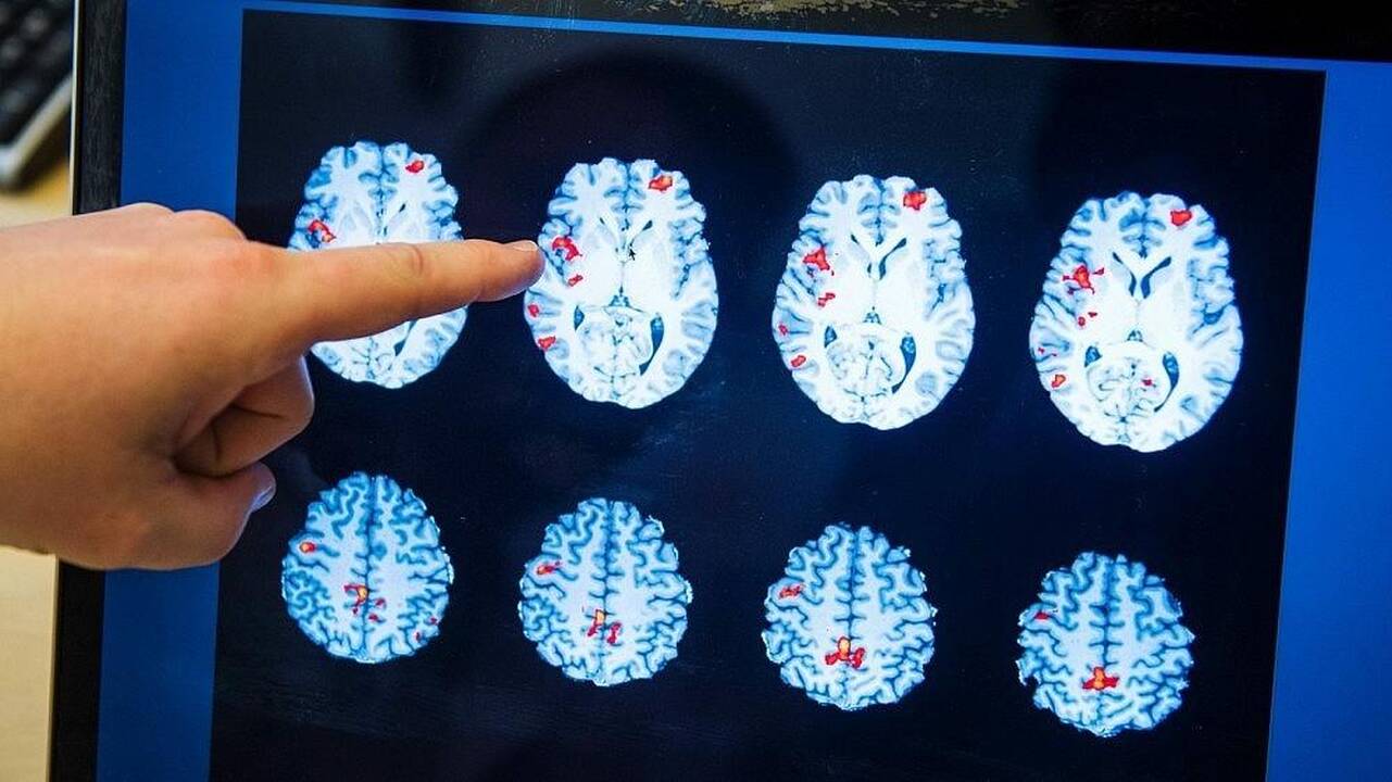 Ar gali būti, kad mūsų smegenys tokios didelės dėl mitybos?