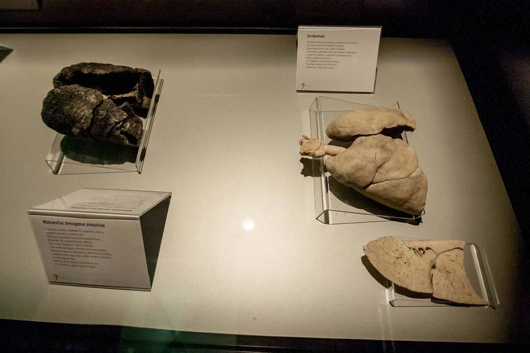 "Body worlds vital" paroda Kaune