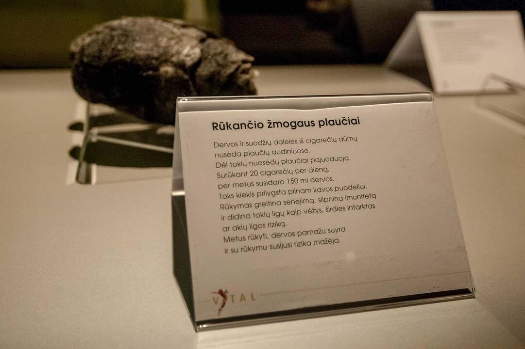 "Body worlds vital" paroda Kaune