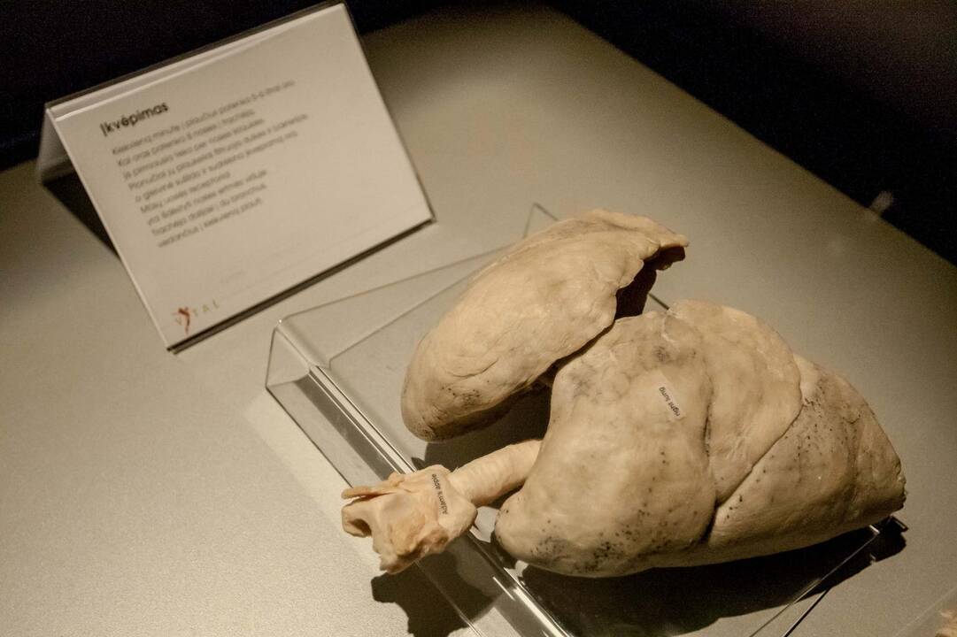 "Body worlds vital" paroda Kaune