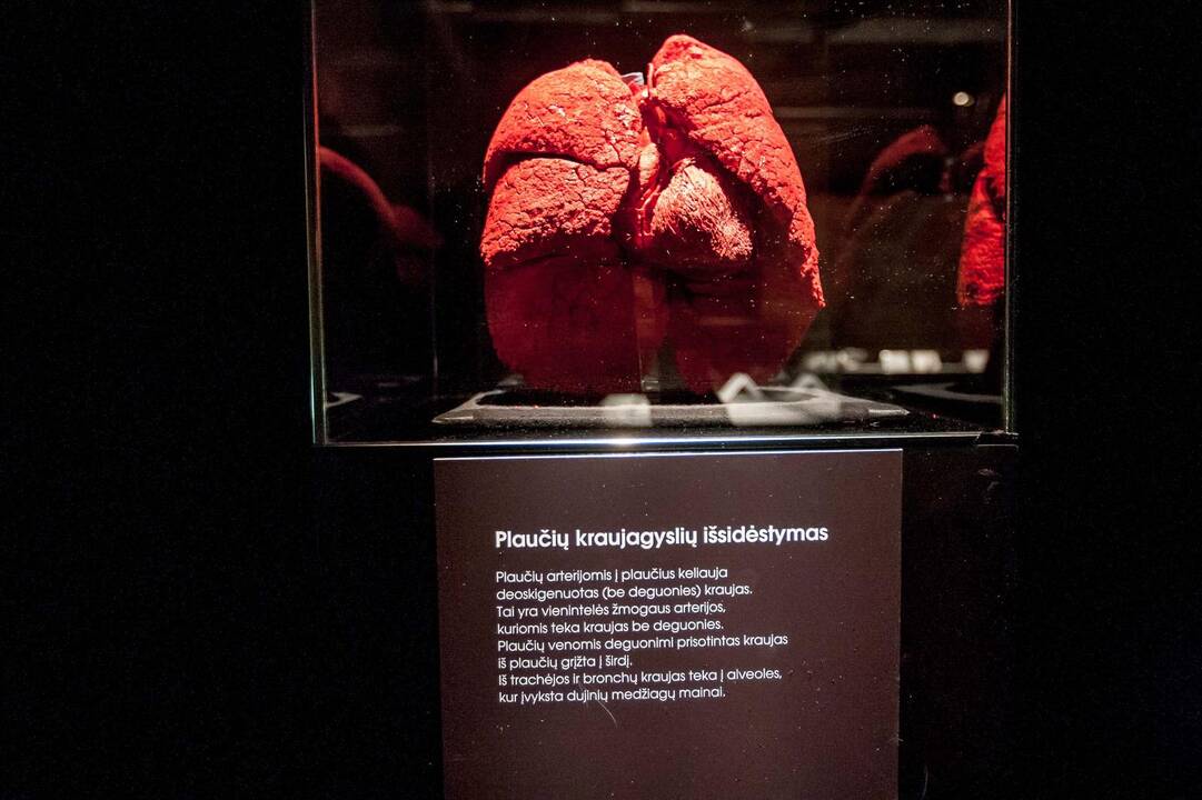 "Body worlds vital" paroda Kaune