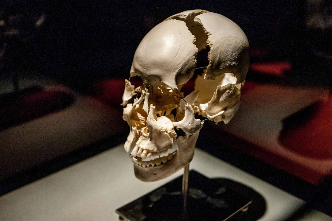 "Body worlds vital" paroda Kaune