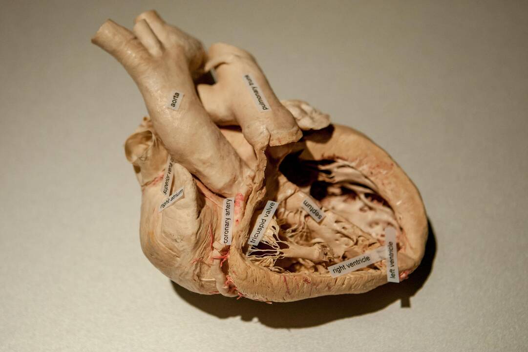 "Body worlds vital" paroda Kaune