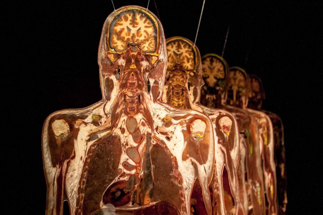 "Body worlds vital" paroda Kaune