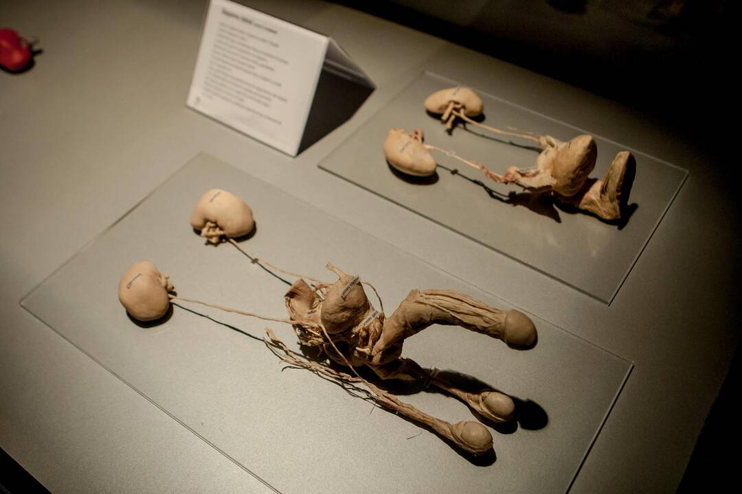 "Body worlds vital" paroda Kaune