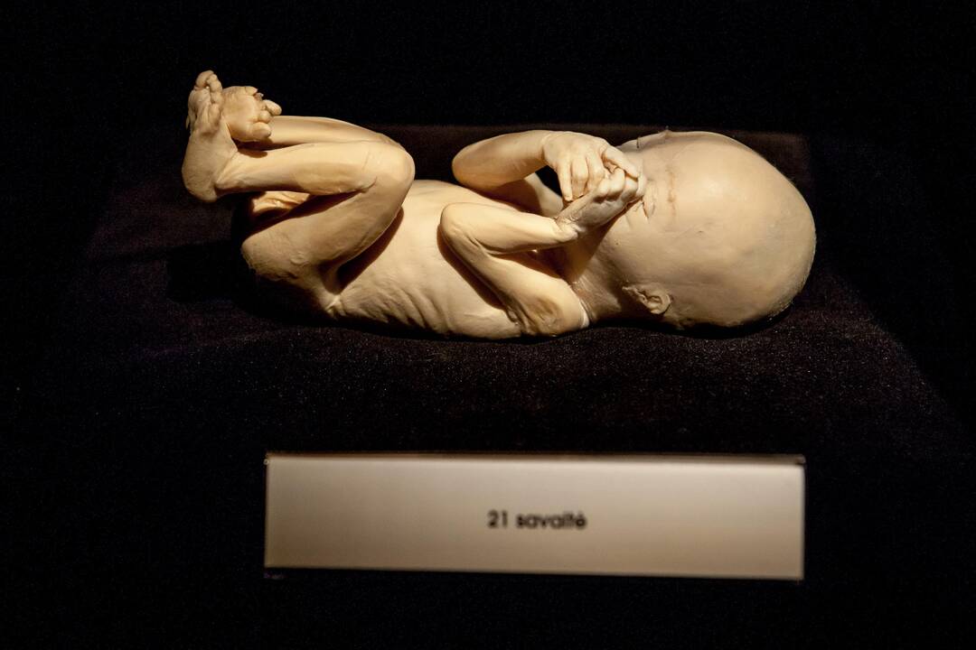 "Body worlds vital" paroda Kaune