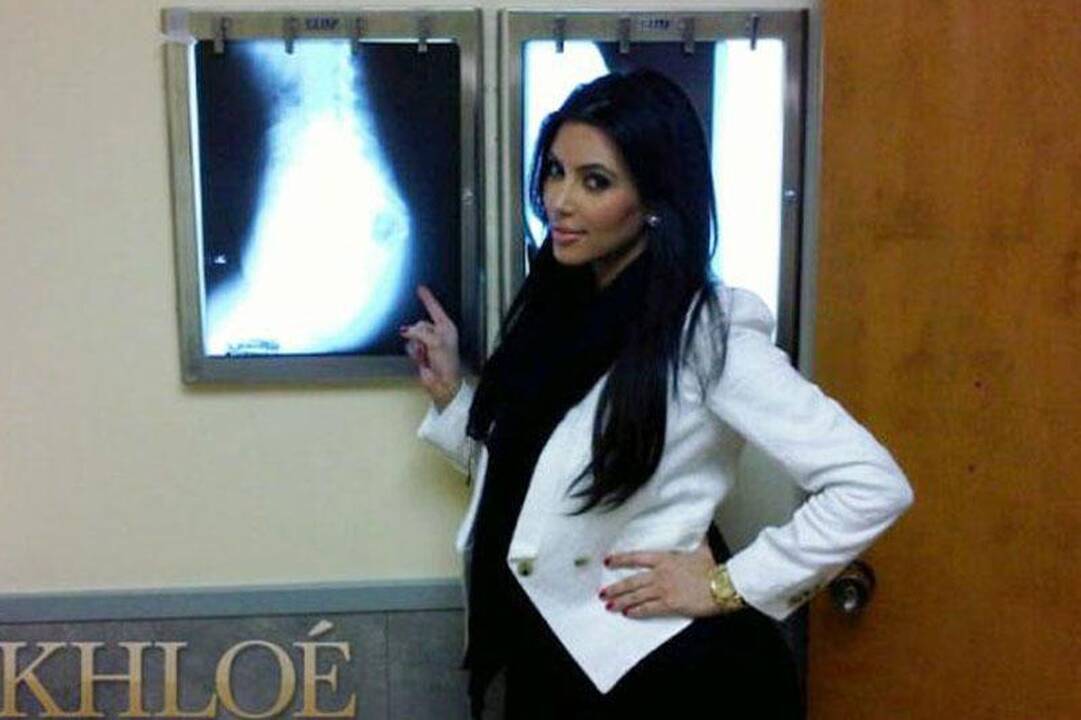 K.Kardashian: mano užpakaliukas nepadidintas implantais