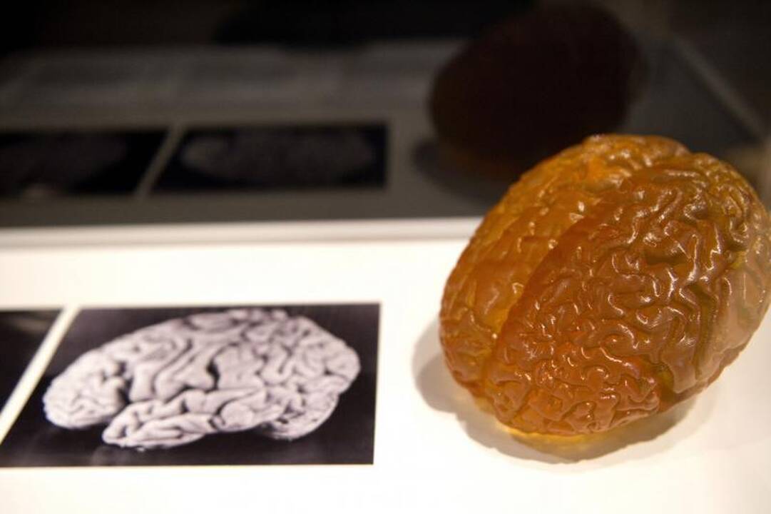 Muziejuje D.Britanijoje eksponuojama dalis A.Einšteino smegenų