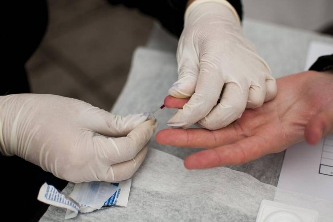 Nemokama ŽIV patikra: 60-metis išgirdo šiurpią diagnozę