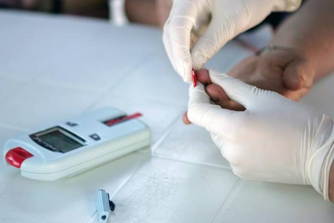 V.Kudirkos aikštėje - apgultis norinčių nemokamai pasimatuoti cholesterolio kiekį